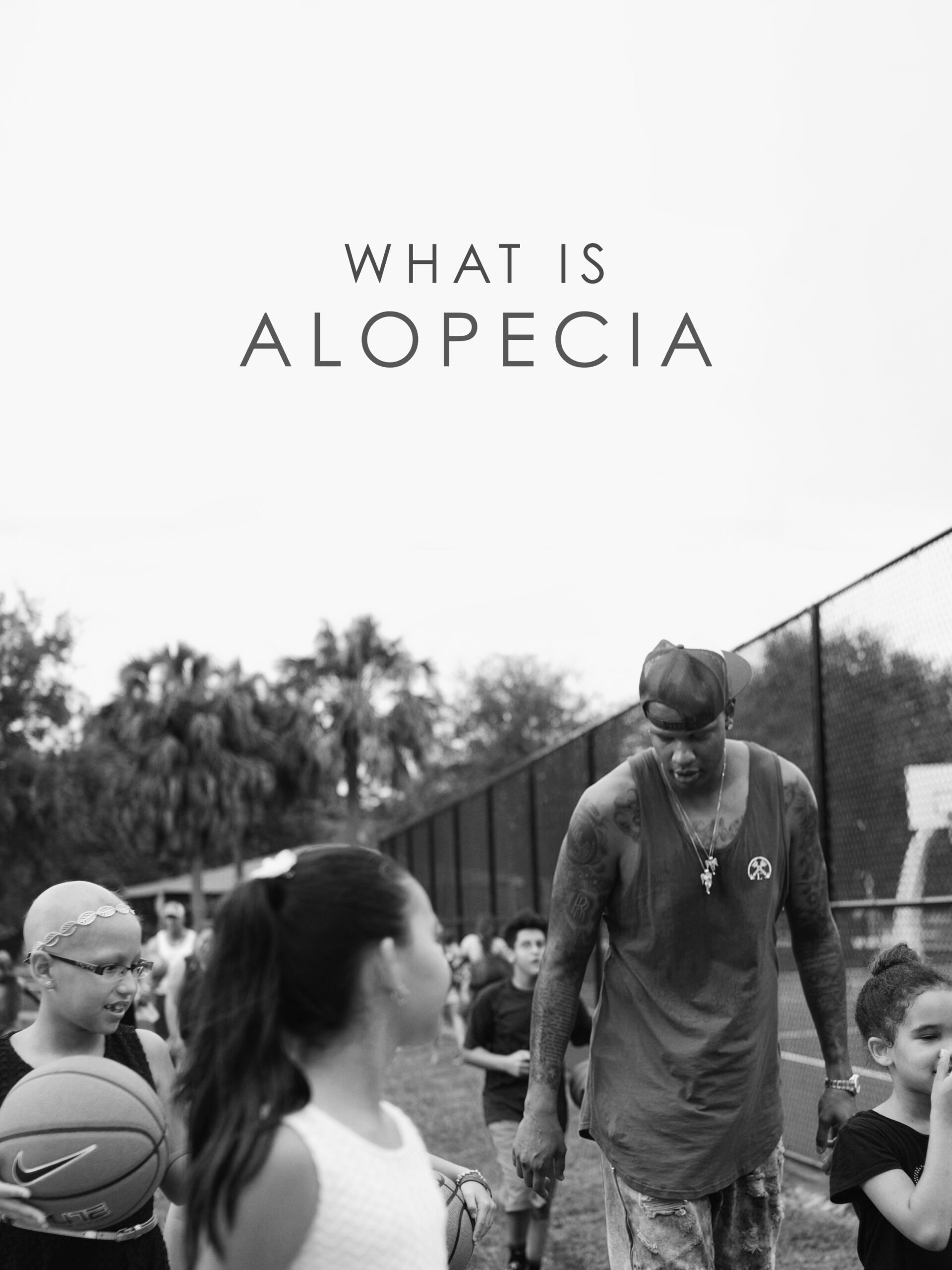 what is alopecia copy